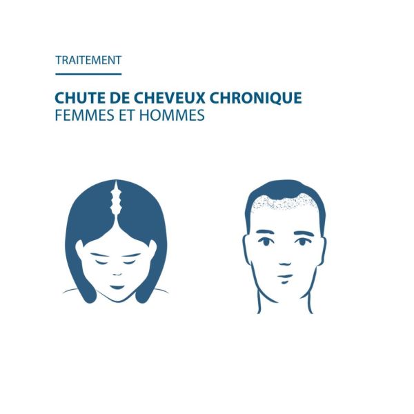 Complément alimentaire Chute de cheveux ANACAPS EXPERT 90 u